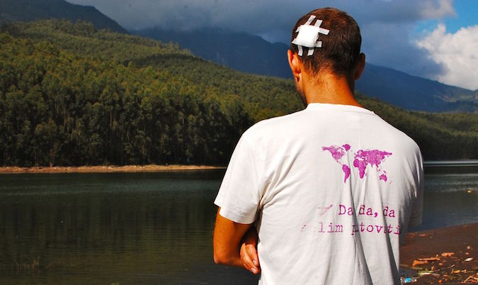 A male traveler with a head injury after a surfing accident stares onto the ocean overseas